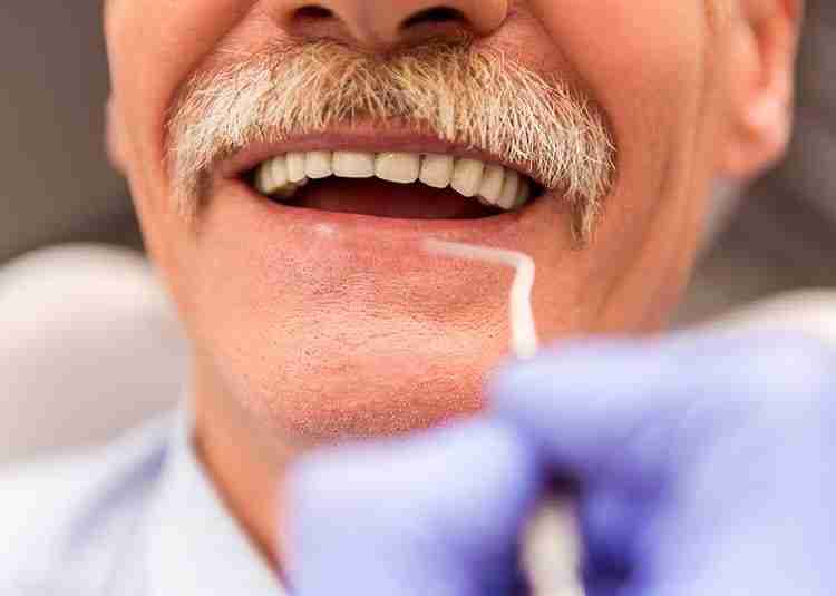 Dental Implants For The Elderly