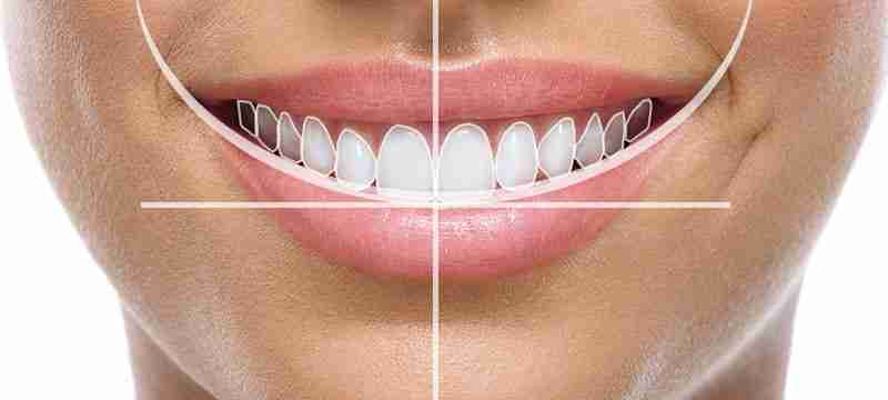 CEREC Digital Dentistry Planning