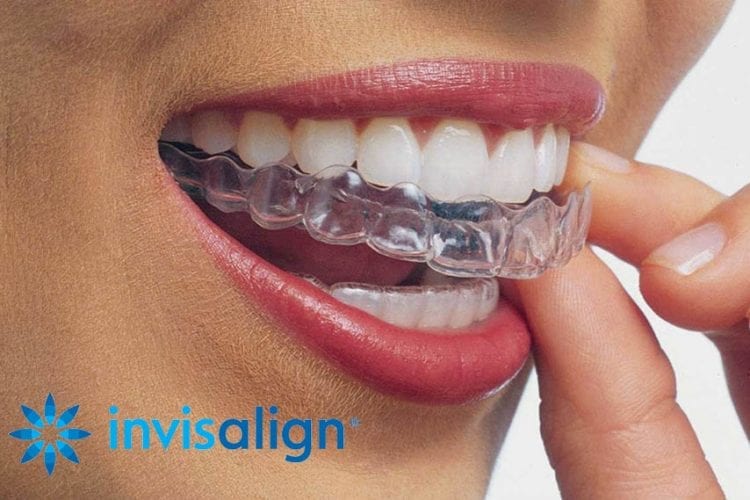 Invisalign New York City